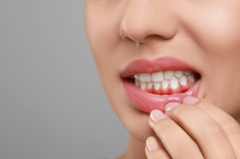 A woman showing her inflamed gums against a gray background